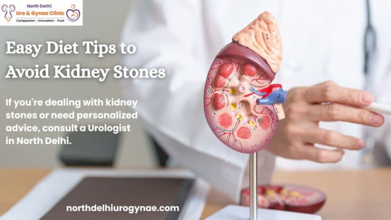 Easy Diet Tips to Avoid Kidney Stones from Your North Delhi Urologist