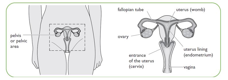 Acute pelvic inflammatory disease