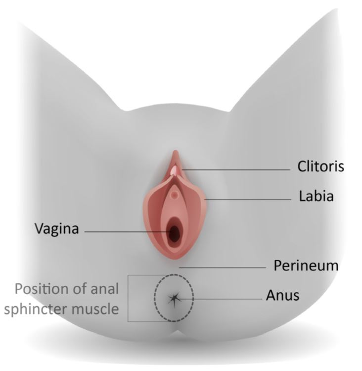 Care of a third- or fourth-degree tear that occurred during childbirth